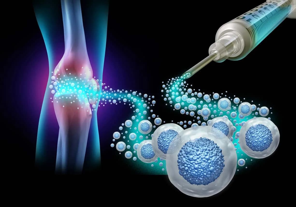 Stem Cell Therapy: San Diego regenerative medicine Google Ads and Microsoft Ads marketing creative.
